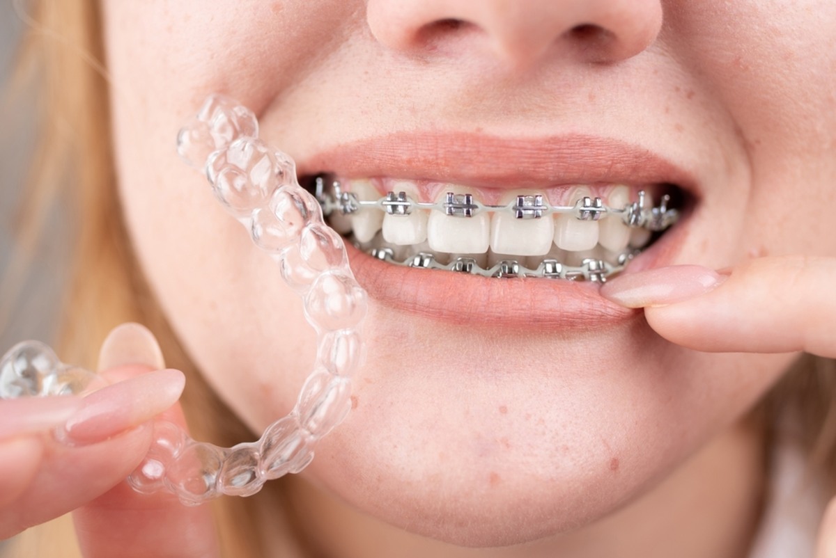 Featured image for “Why Woodbridge Families Are Choosing Modern Orthodontic”