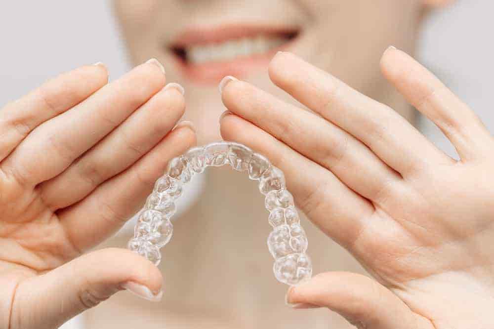 clear-aligners