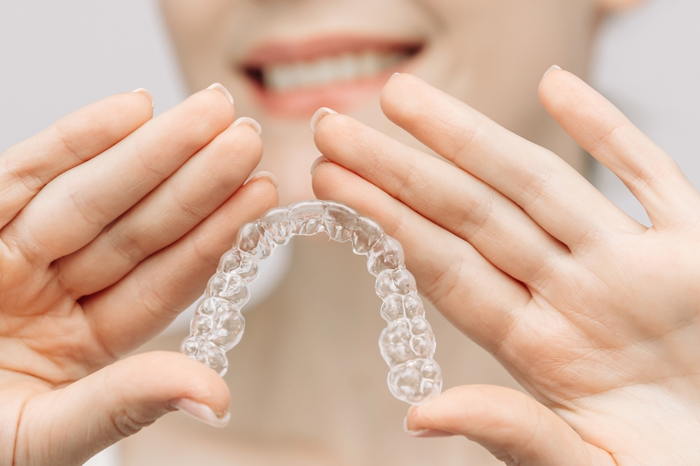clear-aligners