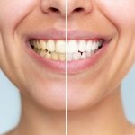 cosmetic dentistry in woodbridge