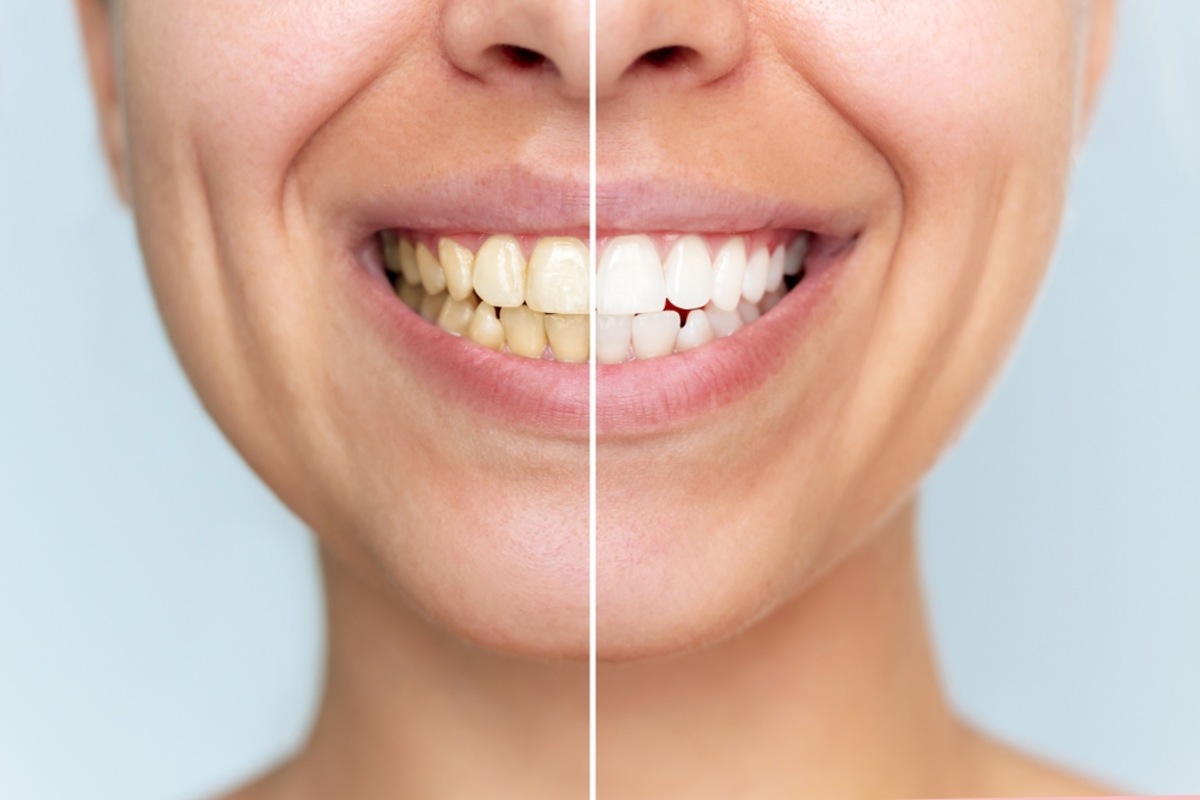 cosmetic dentistry in woodbridge